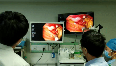 癌症@12天发现18例癌症!消化科主任叹息:许多悲剧原本可以避免的