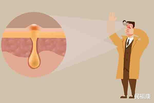 []头皮、后背总是长疙瘩，是怎么回事？别不在意，也可能与疾病有关