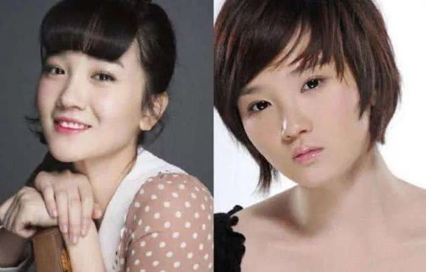 整容|整容最成功的4位女星，虽然已“千刀万剐”，但却毫无痕迹