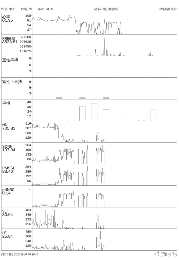 小米科技|小米众筹上线智能动态心电仪，可24小时动态监测，售499元