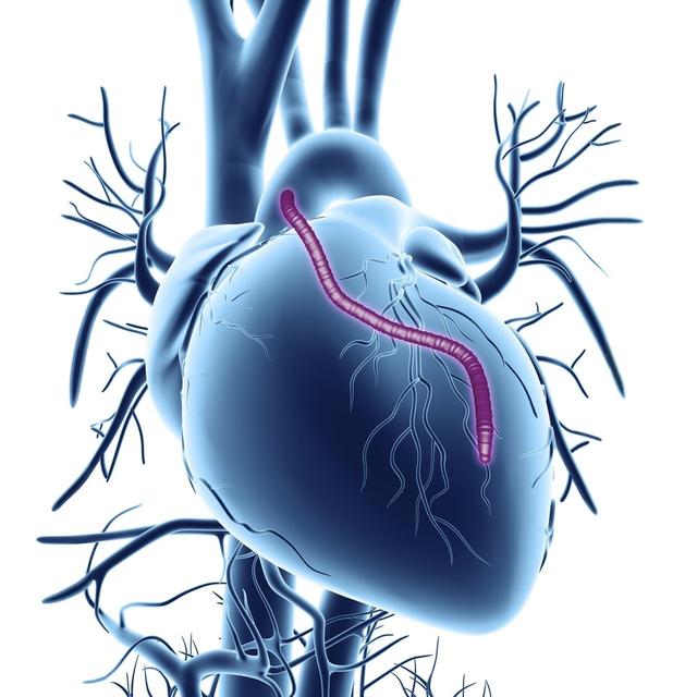 【心脏病】脸上出现4个特征,说明心血管已\堵塞严重\,希望你一个都没有
