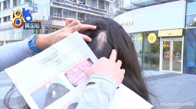 |网红手工耿发明让姑娘斑秃，想自己剪头发还是小米生态链靠谱