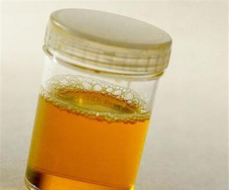 肝脏▲长期喝酒的人，若酒后有“三种表现，两处发臭”，是肝已受损！