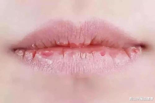 肝脏|肝开始变“硬”时，身体会有这4种“反应”，若一个没占，恭喜你