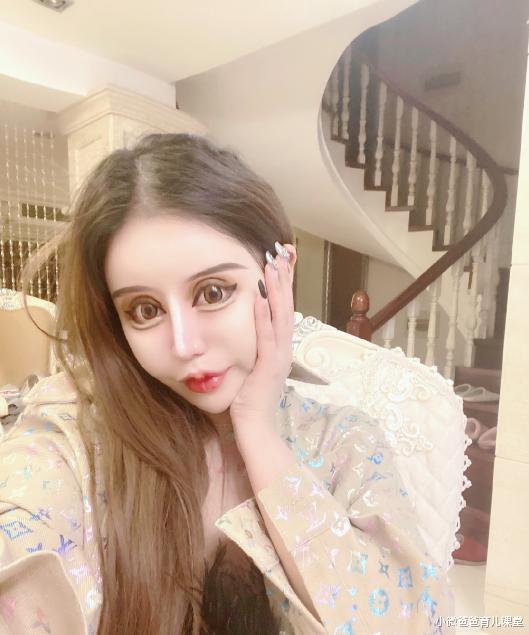 [整容]“网红女孩”13岁开始整容，3年整容100次花费百万，现状令人唏嘘