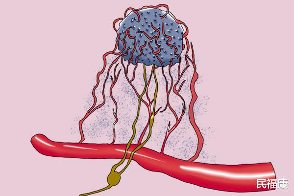 医生|化疗，究竟是延长寿命，还是缩短寿命？医生毫不隐瞒的说出答案