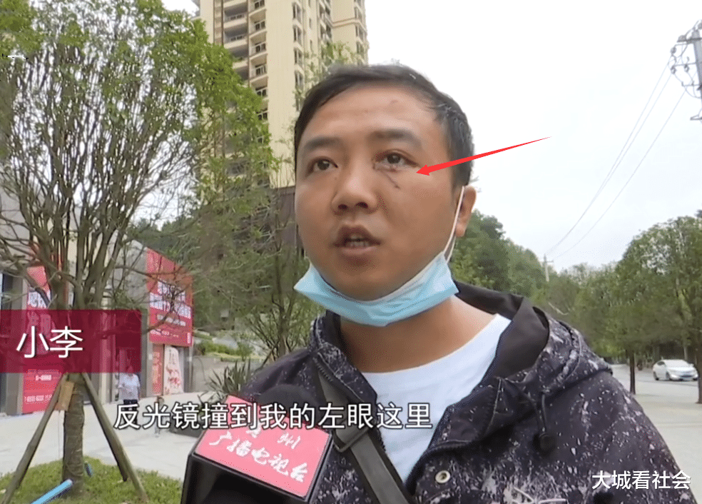 大城看社会|第一天上班送快递，路上翻车撞伤眼睛，站点老板：你不是我员工