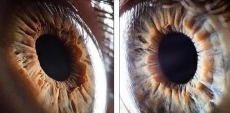 『科学家』扇贝有200多只眼睛,结构比人眼复杂,它们眼中的世界是怎样的