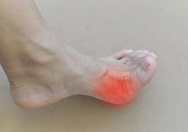 尿酸|尿酸高的人，饮食牢记：少喝3种水，多吃2物，远离痛风困扰