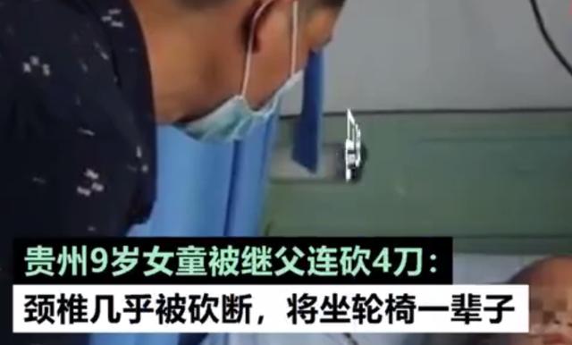 浙江省■母亲和继父闹离婚，贵州9岁女童颈椎被砍断一大半