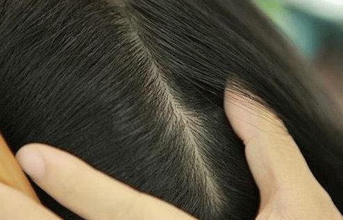 「短发」女生长时间不剪头发, 竟会造成这三种后果! 第三种对颜值影响很大