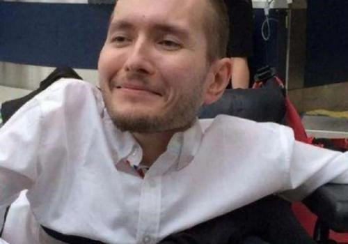 医生|第一个“换头”的猴子，耗时18小时花7000万，成功后它活了多久？