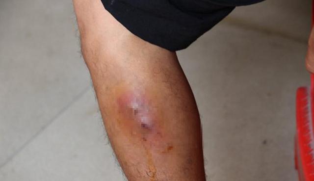 [陕西]要命！凶猛的红火蚁入侵四川，人畜被咬可致休克 村民：太可怕