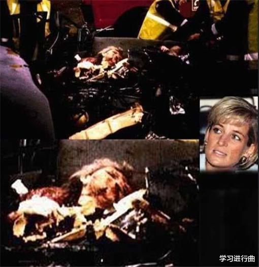 |罕见的老照片：被医生害死的迈克杰克逊，戴安娜被撞的面目全非