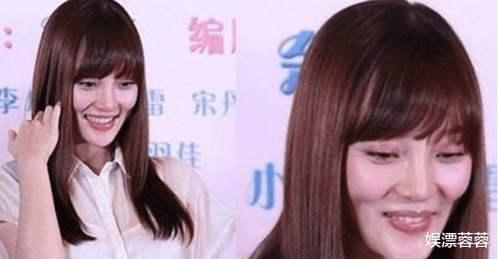 整容|?整容整毁了的5位明星红人， 正常人已无法欣赏你们的盛世美颜了！