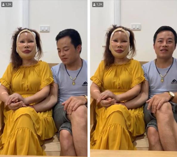 东宏股份：6旬老妇为与27岁丈夫般配再次整容，现面部浮肿多日无法进食