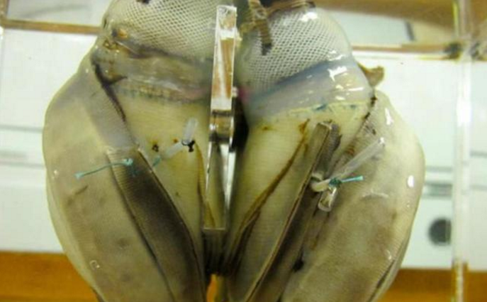 『人工心脏』5万年前的女性遗体中有人造心脏，史前文明到底发展到什么程度？