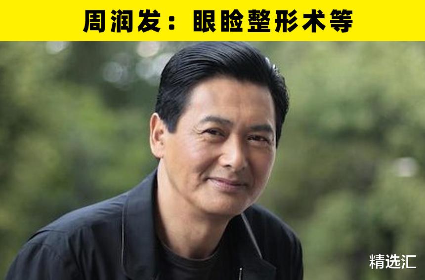 整形|大方承认自己做过整形手术的8名好莱坞明星