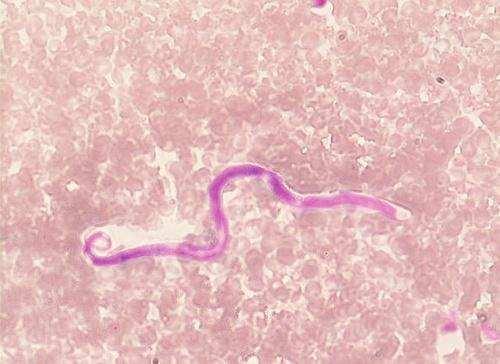 「」这些美食暗藏太多寄生虫，尽量不要碰，别吃出毛病了才后悔！