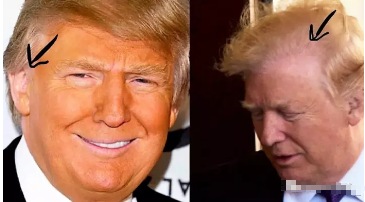 [特朗普]?为什么特朗普的眼袋是白色的？