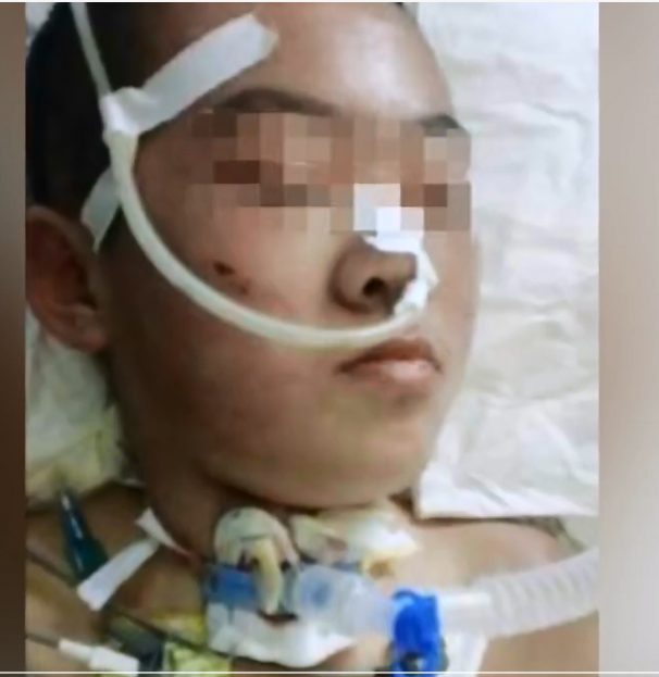 微社评 山西一12岁女孩遭继母虐待，皮肤多处溃烂感染，被虐打成植物人