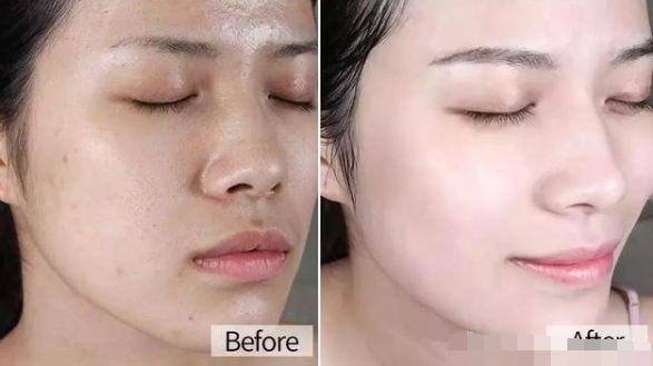 兰蔻|药店有一种不起眼的“精华液”，用后色斑皱纹全没了，堪称平价兰蔻
