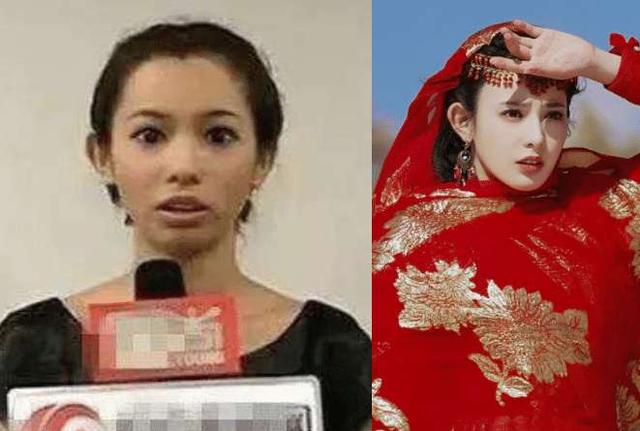 金晨|明星被“包装”前有多普通？彭小苒还好，看到金晨：确定没整容？