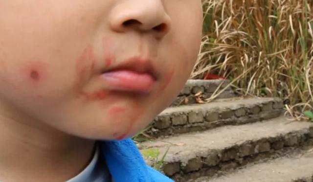 「中毒」紧急提醒！已有4个男孩路边呕吐，一人陷入昏迷！就因为摘了这个吃