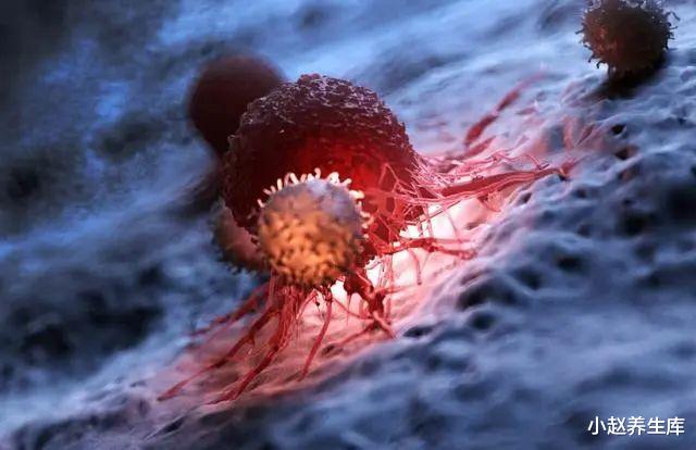 「肝脏」50岁后癌症“高发期”,身体出现“3多2黑”,最好去检查一下!