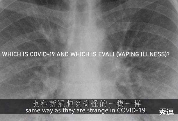 【美国】病毒起源将“浮出水面”!美国称“找到0号病例”,已在网络公开!