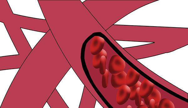 「心脑血管疾病」为什么年龄不大，血管却先变硬？符合这5个条件的人，要多关注了