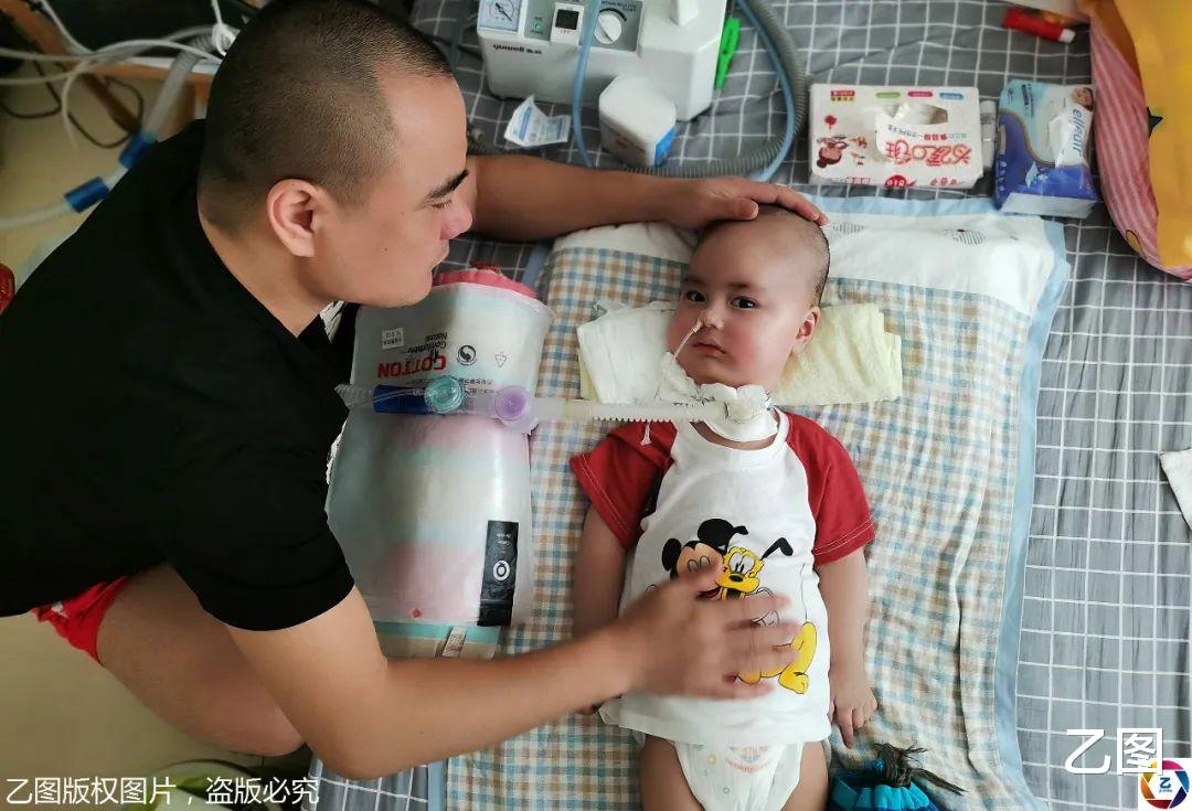 #诺西#一岁大眼男童患罕见病，只有眼珠能动，天价救命药70万元一针