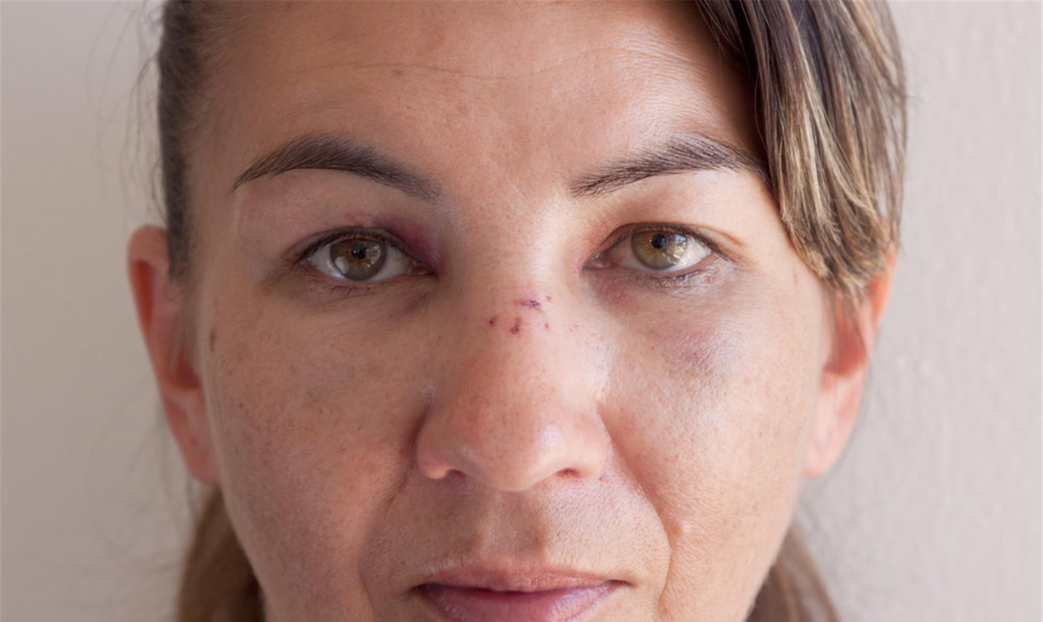 [肝脏]天然“解毒高手”被找到，没事吃点，肝硬化可能打“退堂鼓”