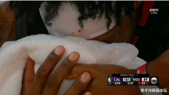 火箭队|火湖G3赛后12小时：考文顿伤情报告出炉 火箭遇更棘手难题 湖人大赚