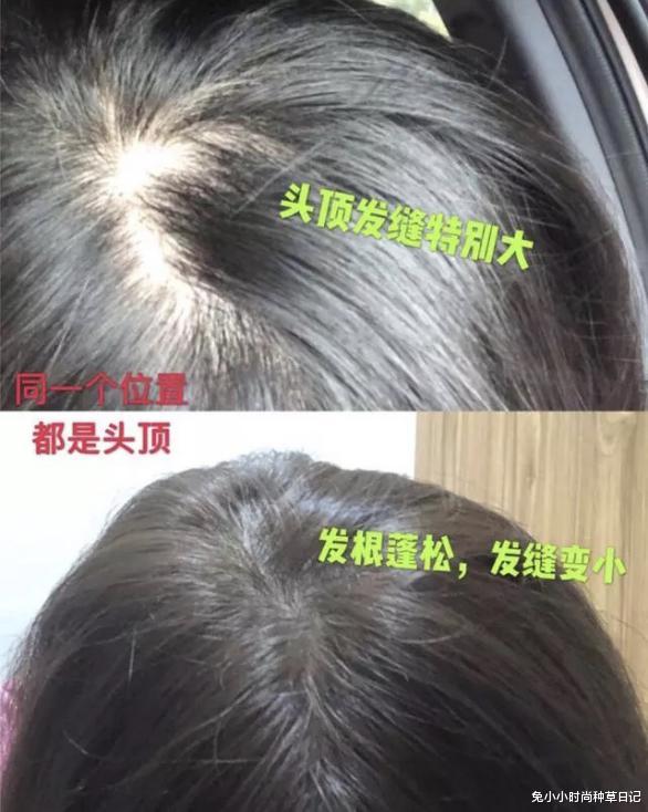 央视曝光市场“夺命毒洗发水”,致癌物超标20多倍!提醒:谨慎购买