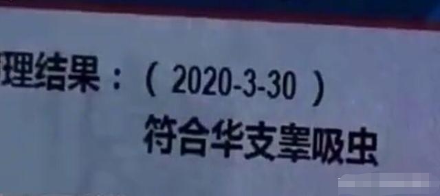 「」女子严重腹痛，手术3天后两条“活虫子”从她体内流出，它可以寄生几十年