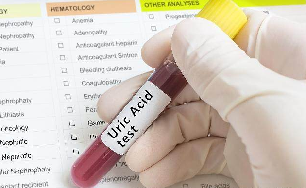 尿酸|它是尿酸的“天敌”，每天坚持吃点，平衡尿酸，“痛风”绕远路！