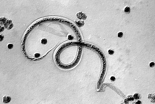 田螺■寄生虫最多的4种美食,聪明的人从来不吃,劝你最好远离