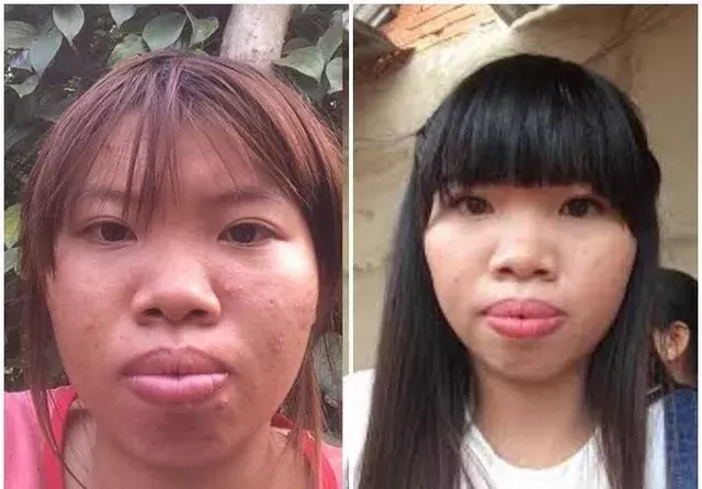 凤姐|越南凤姐：为嫁给富二代花十万整容，孩子出生后，老公拔腿就跑
