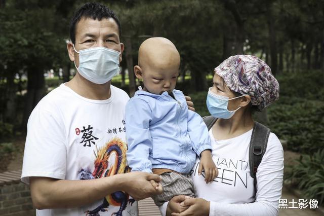 黑土影像|4岁男童眼中长“脏东西”把一只眼球冲破，另一只眼恐怕也保不住