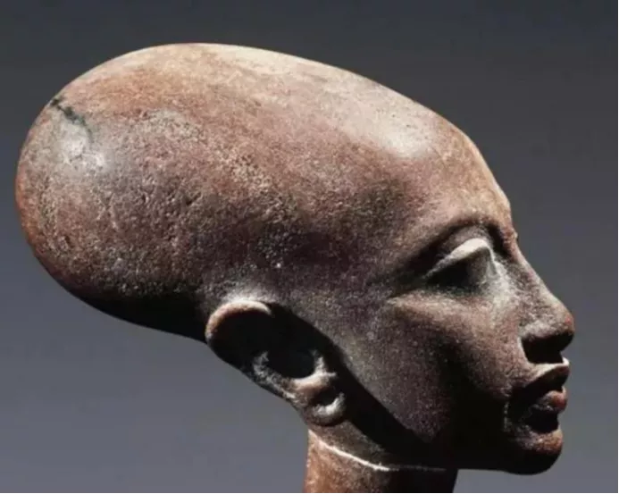 外星人|1500年前，外星人就混进了人类社会？这些畸形头骨或是证据——星协看宇宙