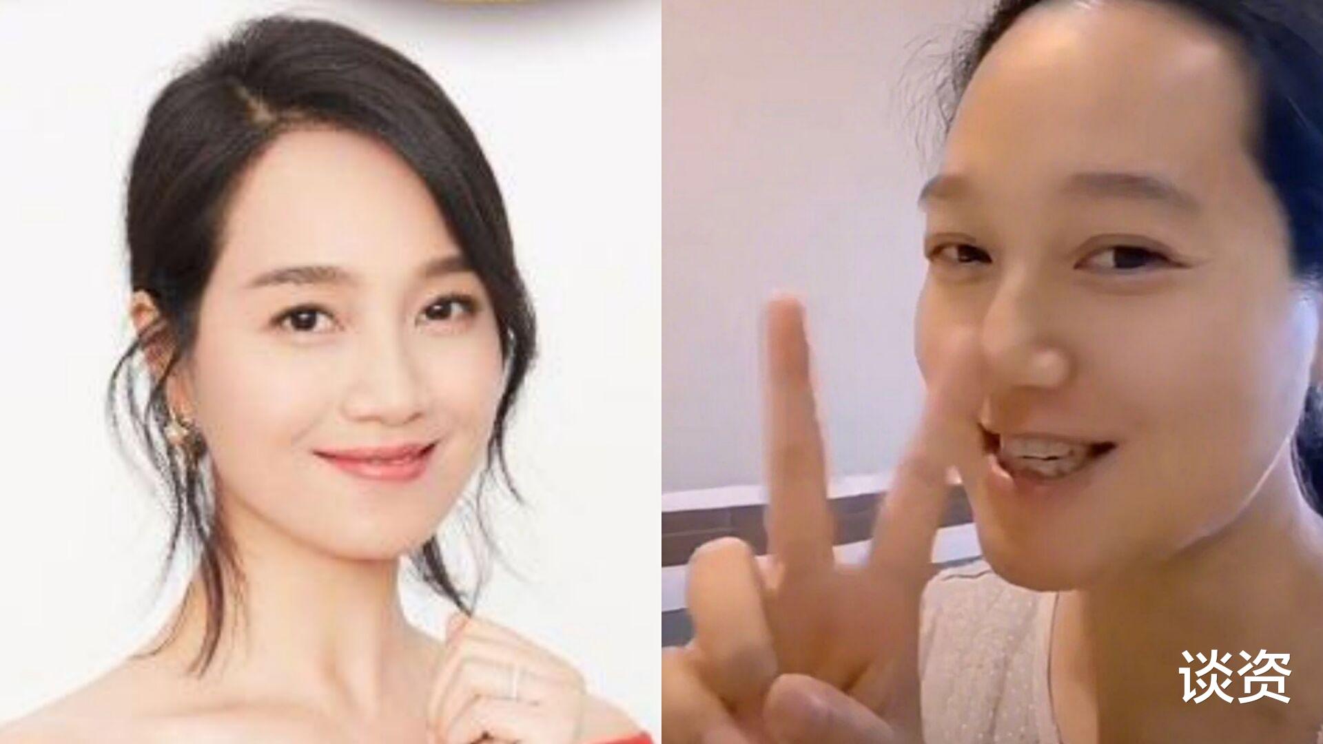 林峰|39岁朱丹晒入院待产，晒丰盛营养餐，面目浮肿到像换了个人