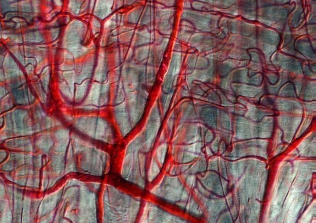 高血脂|高血脂的“祸首”并不是肥肉，此物天天吃，血液或会“浓如粥”