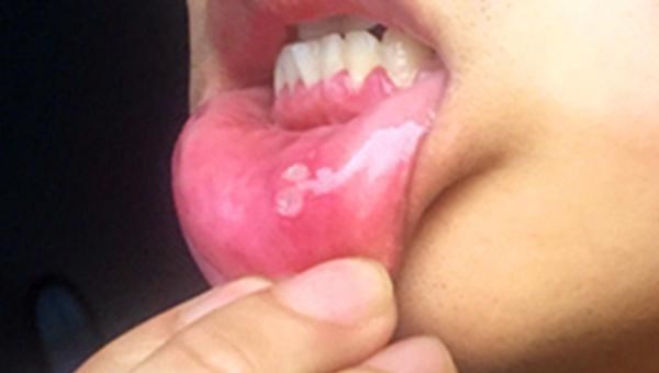 心脏|肝不好，头先知？医生：若头部出现4个迹象，说明你该好好护肝了