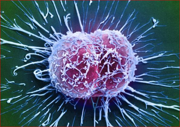 癌细胞|癌细胞为什么要杀死人,人死了它不也死了吗?