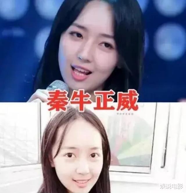 发际线|鞠婧祎高发际线曝光，杨幂被质疑植发，她们二十多岁发际线堪忧