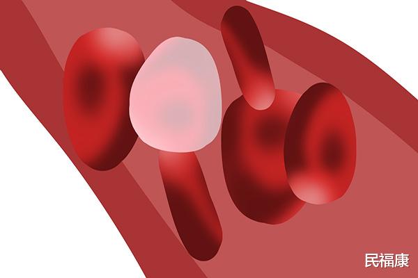 |血脂超标的人，医生：2个降血脂的方法，合理降脂，预防动脉硬化