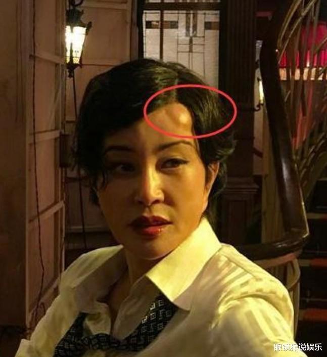 刘晓庆|刘晓庆拍戏摔破相，大方晒出“天然脸”，难怪65岁还能演少女