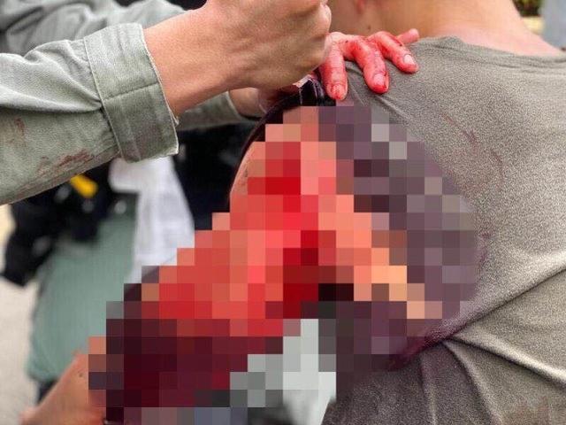 环球时报|被暴徒刺伤港警受“黄医护”粗暴对待，手术翌日竟被院方催赶出院