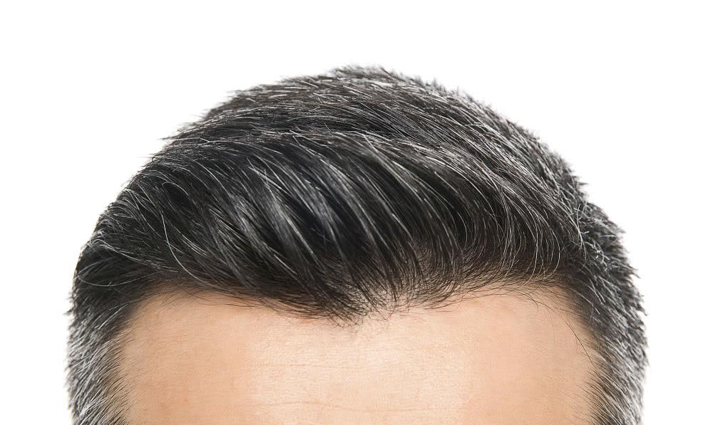 【白发】白发忽然增多，是因为上了岁数？提醒：这4个原因你可能没想到